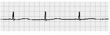 cardiogramma.jpg